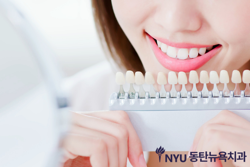 동탄 치아미백 가격, 횟수는 어떻게 진행될까요? - 3