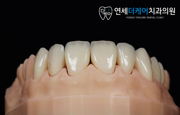 세종 라미네이트, 치아 삭제가 걱정되신다면? 이 글만 보세요