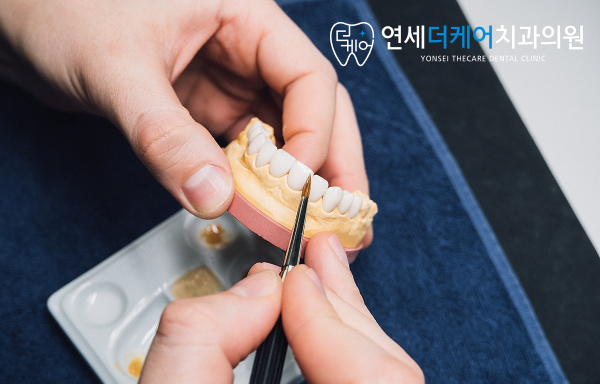 세종 라미네이트, 치아 삭제가 걱정되신다면? 이 글만 보세요 - 2