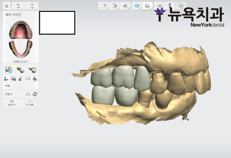 치료 후 확인된 변화 또는 경과 관련 이미지
