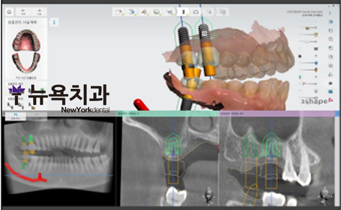 진단과 치료 계획을 세운 기준 관련 이미지