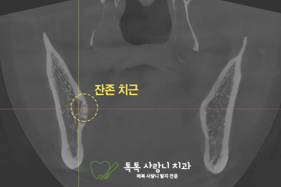 신체적 변화와 발치의 어려움 관련 이미지