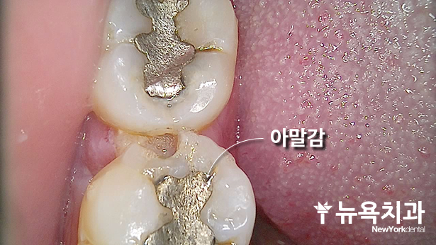 치료 과정 관련 이미지