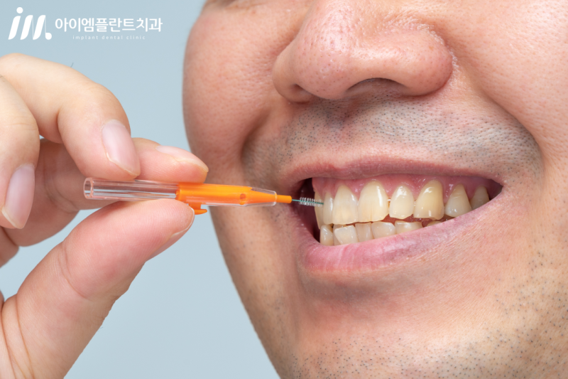임플란트를 오래 사용하기 위한 관리 방법은 무엇인가요? 관련 이미지