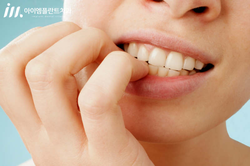 임플란트 수명에 영향을 미치는 요소는 무엇인가요? 관련 이미지