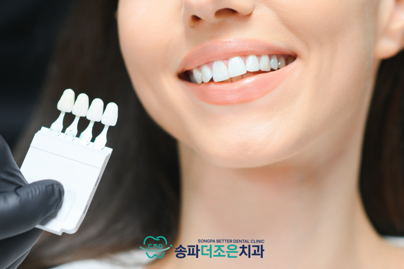 원데이 치아미백이란 무엇인가? 관련 이미지