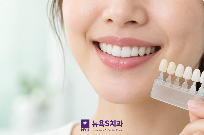 치아미백이 민감한 치아에 안전한가요? 관련 이미지