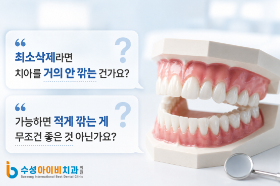 최소삭제 라미네이트란 무엇인가? 관련 이미지